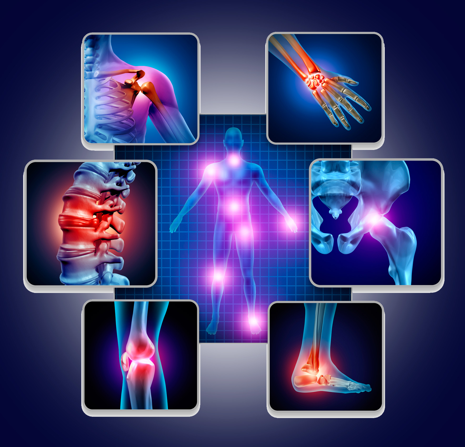 Infográfico: Conheça a Osteoartrite