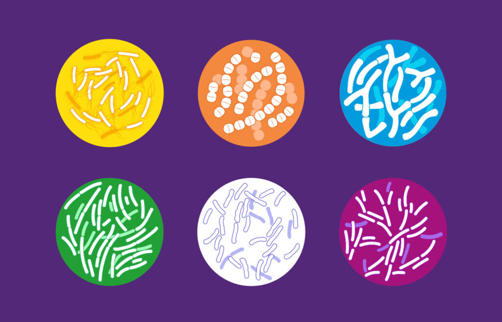 Existe vantagem de probiótico multicepas x cepa única?