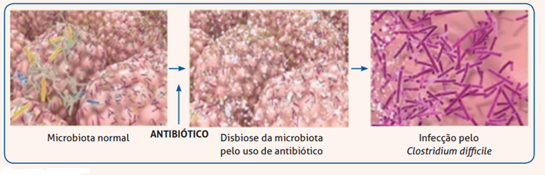 Diarreia associada ao uso de antibióticos
